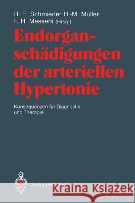 Endorganschädigungen Der Arteriellen Hypertonie -- Konsequenzen Für Diagnostik Und Therapie Schmieder, Roland E. 9783540535812 Not Avail - książka