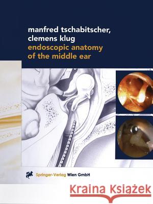 Endoscopic Anatomy of the Middle Ear Manfred Tschabitscher Clemens Klug 9783709172315 Springer - książka