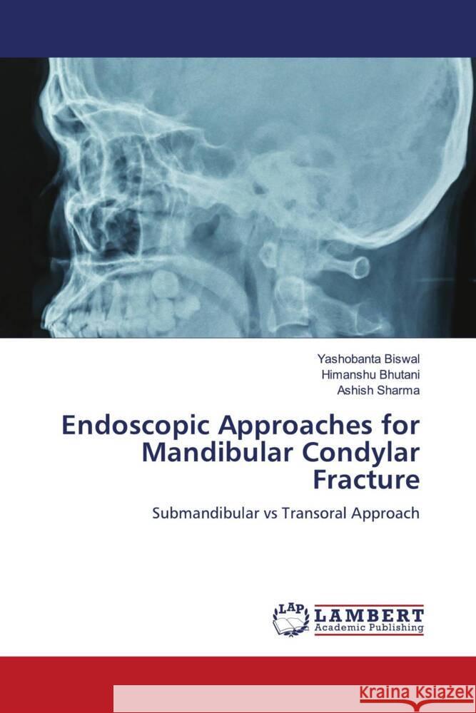 Endoscopic Approaches for Mandibular Condylar Fracture Yashobanta Biswal Himanshu Bhutani Ashish Sharma 9786207471362 LAP Lambert Academic Publishing - książka