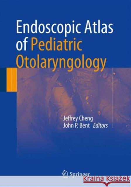 Endoscopic Atlas of Pediatric Otolaryngology Jeffrey Cheng John P. Bent 9783319294698 Springer - książka