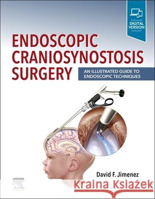 Endoscopic Craniosynostosis Surgery: An Illustrated Guide to Endoscopic Techniques David F. Jimenez 9780323721752 Elsevier - książka
