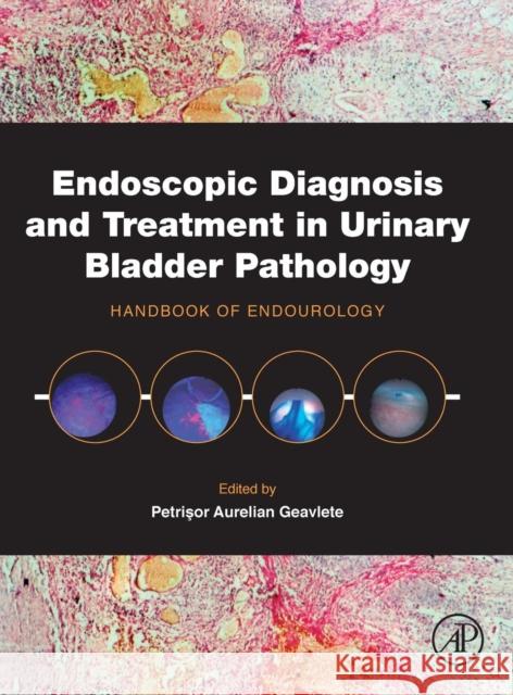 Endoscopic Diagnosis and Treatment in Urinary Bladder Pathology: Handbook of Endourology Petrisor Aurelian Geavlete 9780128024393 ACADEMIC PRESS - książka