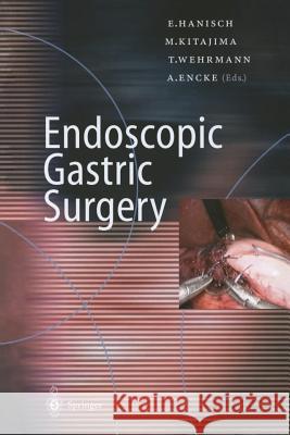 Endoscopic Gastric Surgery E. Hanisch M. Kitajima T. Wehrmann 9783642640452 Springer - książka