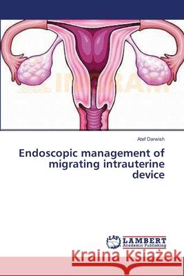Endoscopic management of migrating intrauterine device Darwish Atef 9783659548406 LAP Lambert Academic Publishing - książka