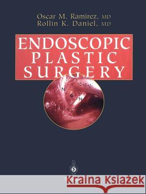 Endoscopic Plastic Surgery Oscar M. Ramirez Rollin K. Daniel 9781461275046 Springer - książka