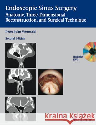 Endoscopic Sinus Surgery: Anatomy, Three-Dimensional Reconstruction, and Surgical Technique [With DVD] P. J. Wormald Peter-John Wormald 9781588906038 Thieme Medical Publishers - książka