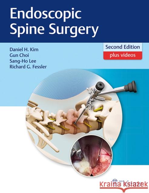 Endoscopic Spine Surgery Daniel H. Kim Gun Choi Sang-Ho Lee 9781626232648 Thieme Medical Publishers - książka
