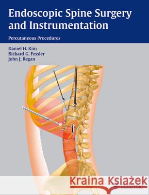 Endoscopic Spine Surgery and Instrumentation Daniel H. Kim 9781588902252 Thieme Medical Publishers - książka