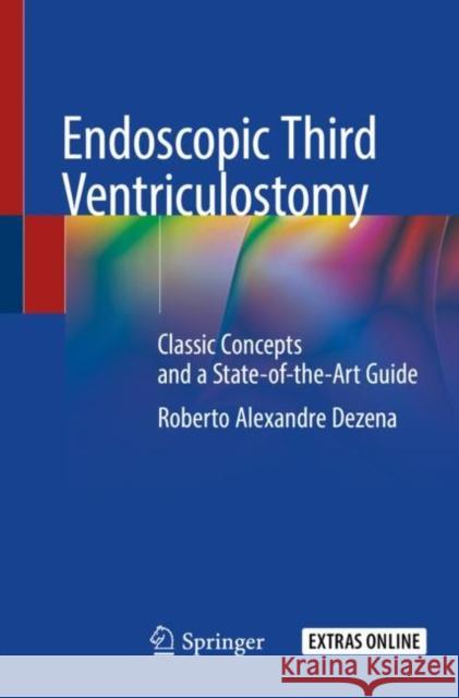 Endoscopic Third Ventriculostomy: Classic Concepts and a State-Of-The-Art Guide Roberto Alexandre Dezena 9783030286590 Springer - książka