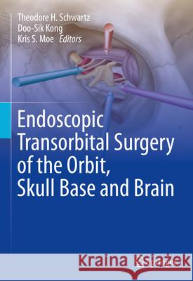 Endoscopic Transorbital Surgery of the Orbit, Skull Base and Brain Theodore H. Schwartz Doo-Sik Kong Kris S. Moe 9783031595035 Springer - książka