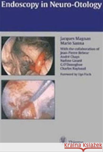 Endoscopy in Neuro-Otology and Skull Base Surgery (At) Magnan, Jacques 9783131130617 Thieme Publishing Group - książka