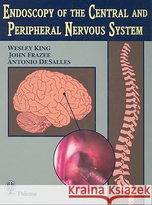 Endoscopy of the Central and Peripheral Nervous System King                                     Wesley King John Frazee 9780865776906 Thieme Medical Publishers - książka