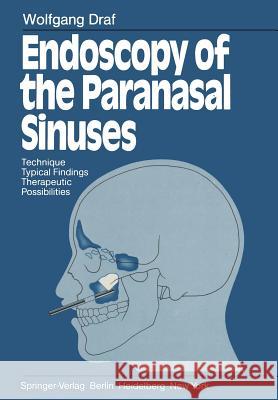 Endoscopy of the Paranasal Sinuses: Technique - Typical Findings Therapeutic Possibilities Draf, Wolfgang 9783642684142 Springer - książka