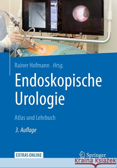 Endoskopische Urologie: Atlas Und Lehrbuch Hofmann, Rainer 9783662539804 Springer - książka