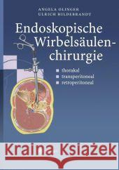 Endoskopische Wirbelsäulenchirurgie: Thorakal - Transperitoneal - Retroperitoneal Olinger, Angela 9783642630583 Springer - książka