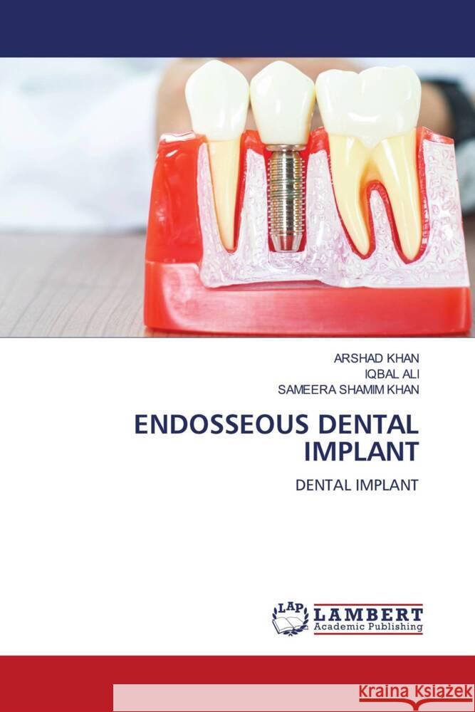 ENDOSSEOUS DENTAL IMPLANT Khan, Arshad, Ali, Iqbal, Khan, Sameera Shamim 9786204742106 LAP Lambert Academic Publishing - książka