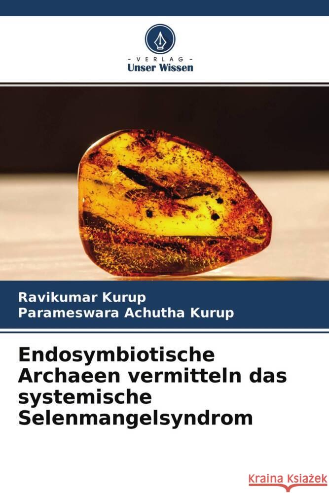Endosymbiotische Archaeen vermitteln das systemische Selenmangelsyndrom Kurup, Ravikumar, Achutha Kurup, Parameswara 9786204657134 Verlag Unser Wissen - książka