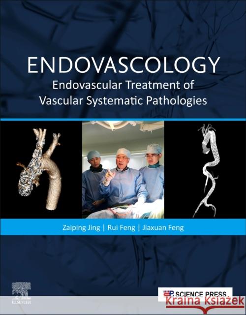 Endovascology: Endovascular Treatment of Vascular Systematic Pathologies Zaiping Jing Jiaxuan Feng 9780323899277 Elsevier - książka