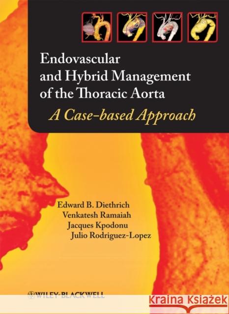 Endovascular and Hybrid Management of the Thoracic Aorta: A Case-Based Approach Ramaiah, Venkatesh 9781405175357 Blackwell Publishers - książka