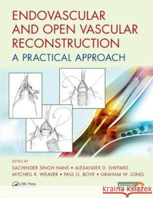 Endovascular and Open Vascular Reconstruction: A Practical Approach S. S. Hans Mitchell R. Weaver Paul G. Bove 9781498760553 CRC Press - książka