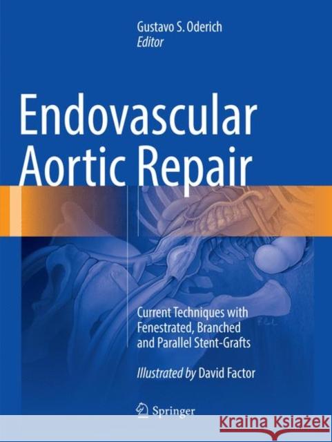 Endovascular Aortic Repair: Current Techniques with Fenestrated, Branched and Parallel Stent-Grafts Oderich, Gustavo S. 9783319792149 Springer - książka