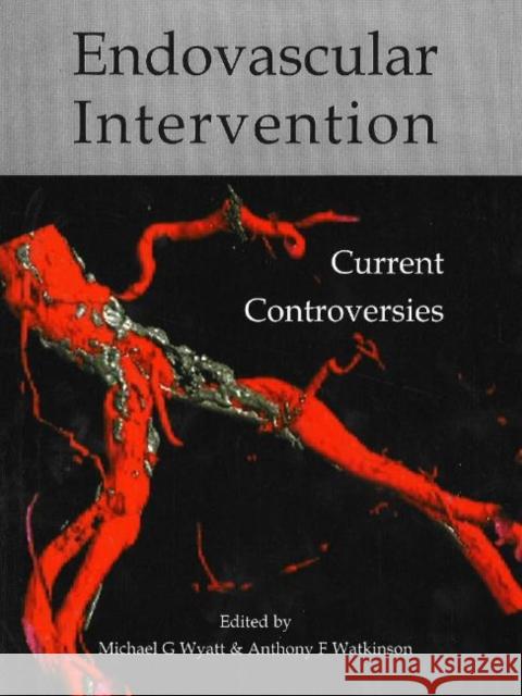 Endovascular Intervention: Current Controversies Wyatt, Michael G. 9781903378311 TFM PUBLISHING LTD - książka