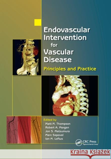 Endovascular Intervention for Vascular Disease: Principles and Practice Matt M. Thompson Robert A. Morgan Jon S. Matsumura 9780367387907 CRC Press - książka
