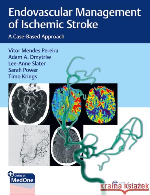 Endovascular Management of Ischemic Stroke: A Case-Based Approach Vitor Pereira Adam Dmytriw Lee-Anne Slater 9781626232754 Thieme Medical Publishers - książka