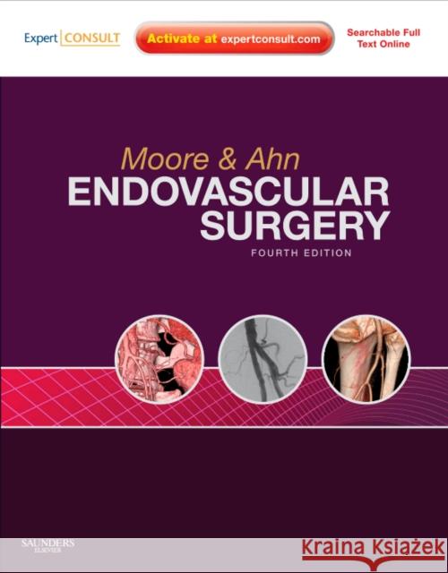 Endovascular Surgery: Expert Consult - Online and Print, with Video Moore, Wesley S. 9781416062080 SAUNDERS - książka