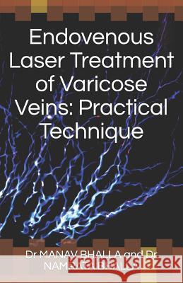 Endovenous Laser Treatment of Varicose Veins: Practical Technique Namrata Bhalla Deepali Bhalla Dr Manav Bhalla and Dr Namrata Bhalla 9781719843966 Independently Published - książka