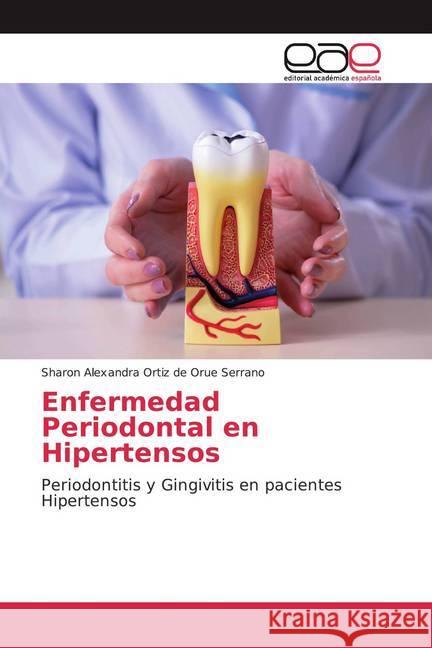 Enfermedad Periodontal en Hipertensos : Periodontitis y Gingivitis en pacientes Hipertensos Ortiz de Orue Serrano, Sharon Alexandra 9786200036124 Editorial Académica Española - książka