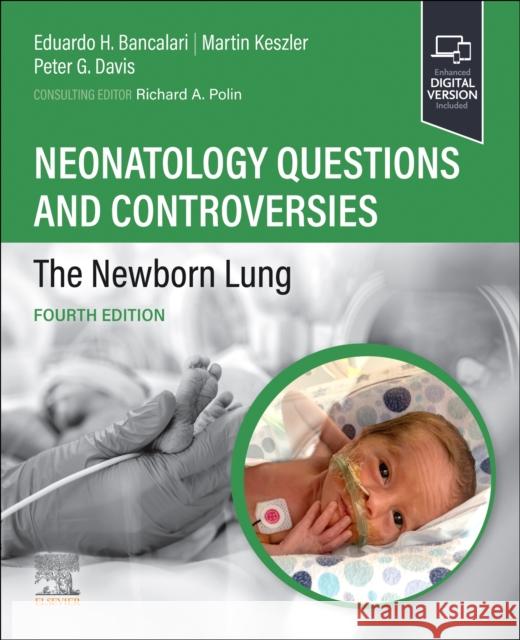 Neonatology Questions and Controversies: The Newborn Lung  9780323878746 Elsevier - Health Sciences Division - książka