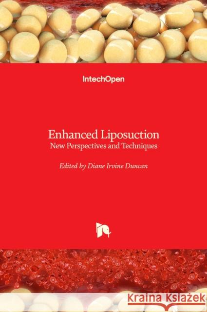 Enhanced Liposuction: New Perspectives and Techniques Diane Irvine Duncan   9781839628238 Intechopen - książka
