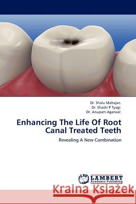 Enhancing The Life Of Root Canal Treated Teeth Dr Shalu Mahajan, Dr Shashi P Tyagi, Dr Anupam Agarwal 9783845422039 LAP Lambert Academic Publishing - książka