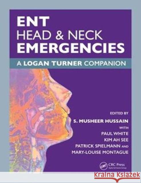 Ent, Head & Neck Emergencies: A Logan Turner Companion S. Musheer Hussain 9781138626423 CRC Press - książka