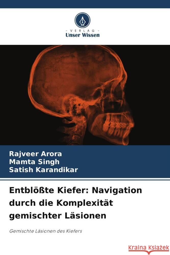 Entbl??te Kiefer: Navigation durch die Komplexit?t gemischter L?sionen Rajveer Arora Mamta Singh Satish Karandikar 9786208152154 Verlag Unser Wissen - książka