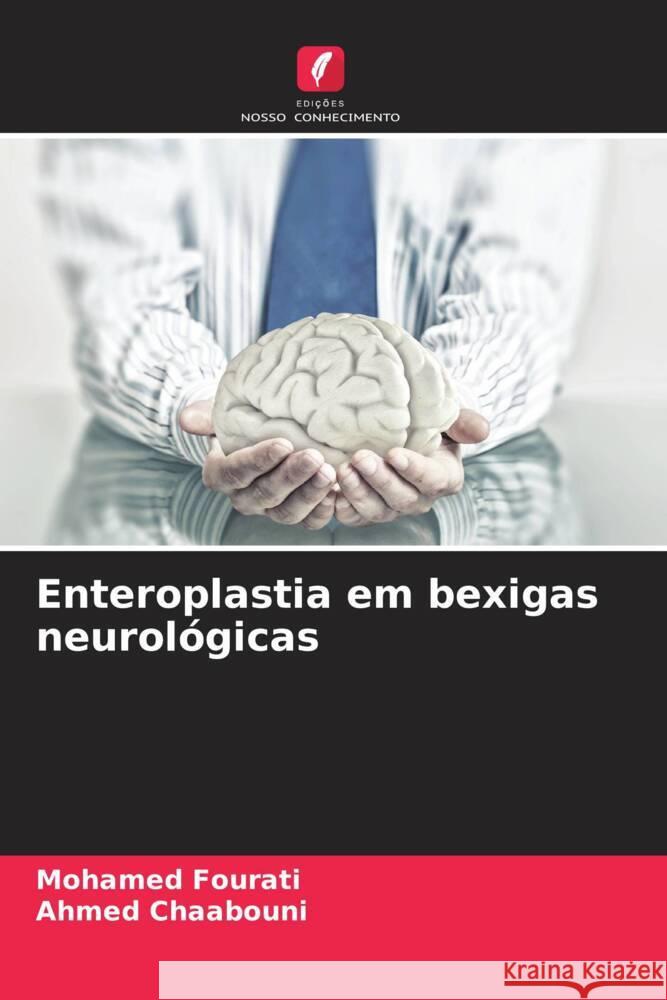 Enteroplastia em bexigas neurol?gicas Mohamed Fourati Ahmed Chaabouni 9786207265909 Edicoes Nosso Conhecimento - książka