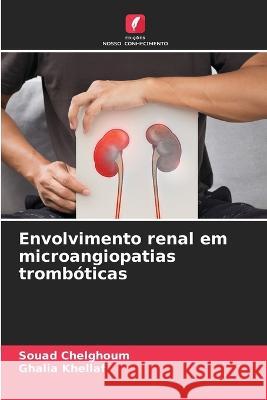 Envolvimento renal em microangiopatias tromb?ticas Souad Chelghoum Ghalia Khellaf 9786205806289 Edicoes Nosso Conhecimento - książka