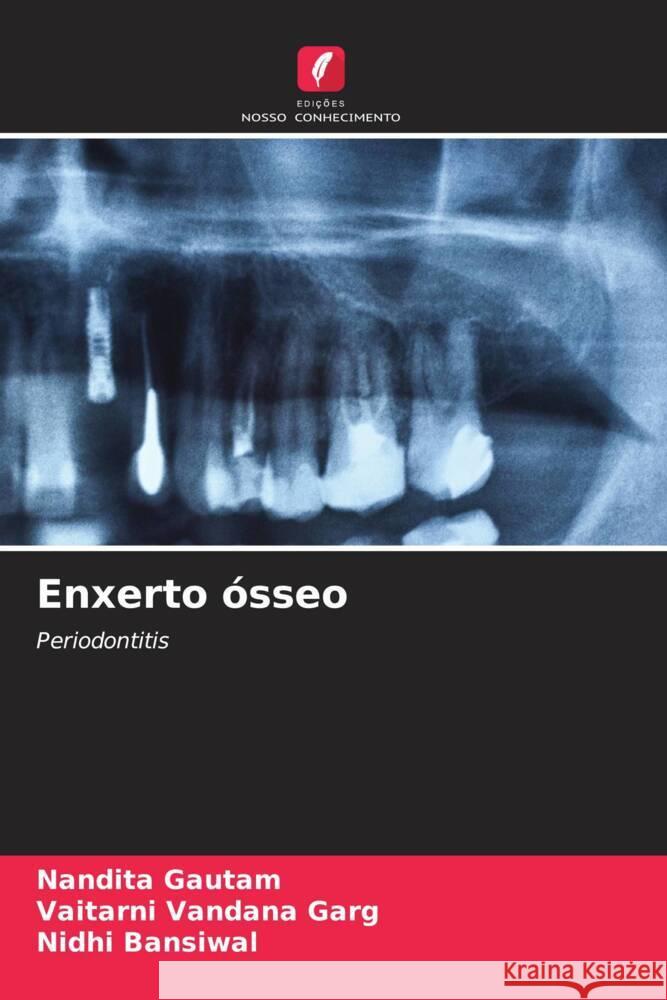 Enxerto ósseo Gautam, Nandita, Garg, Vaitarni Vandana, Bansiwal, Nidhi 9786205051177 Edições Nosso Conhecimento - książka