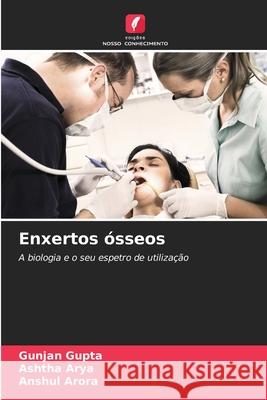 Enxertos ósseos Gupta, Gunjan, Arya, Ashtha, Arora, Anshul 9786208799786 Edições Nosso Conhecimento - książka