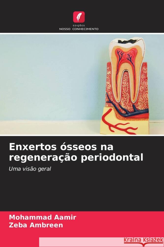 Enxertos ?sseos na regenera??o periodontal Mohammad Aamir Zeba Ambreen 9786208634605 Edicoes Nosso Conhecimento - książka