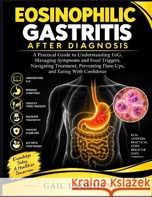 Eosinophilic Gastritis After Diagnosis: A Practical Guide to Understanding EoG, Managing Symptoms and Food Triggers, Navigating Treatment, Preventing Lookman, Gail 9798172976261 Independently Published - książka