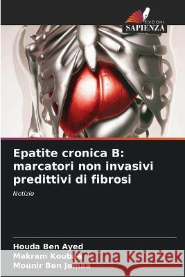 Epatite cronica B: marcatori non invasivi predittivi di fibrosi Houda Be Makram Koubaa Mounir Be 9786205582701 Edizioni Sapienza - książka