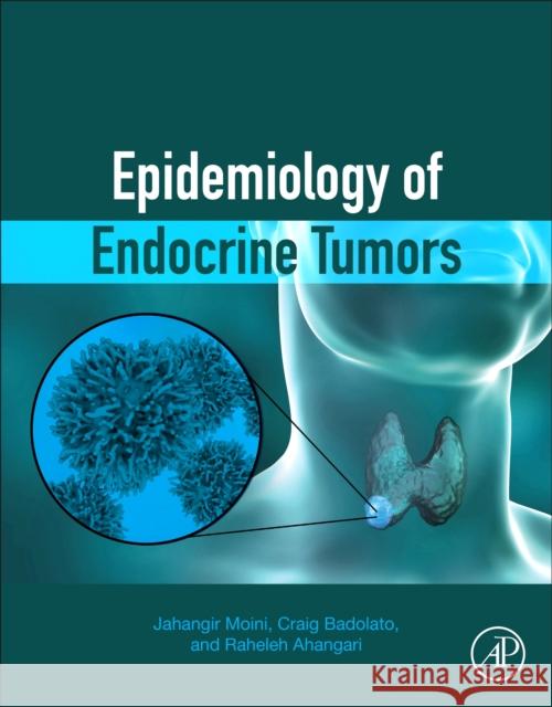 Epidemiology of Endocrine Tumors Jahangir Moini Craig Badolato Raheleh Ahangari 9780128221877 Elsevier - książka