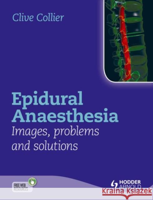 Epidural Anaesthesia: Images, Problems and Solutions  Collier 9781444156041  - książka