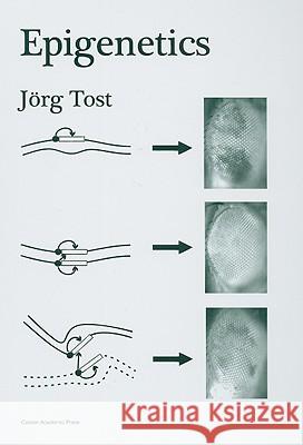 Epigenetics Jorg Tost Jorg Tost 9781904455233 Caister Academic Press - książka