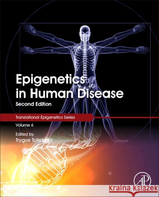 Epigenetics in Human Disease  9780128122150  - książka