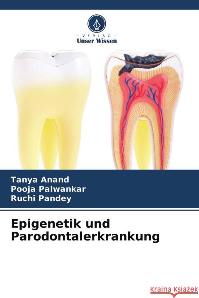 Epigenetik und Parodontalerkrankung Anand, Tanya, Palwankar, Pooja, Pandey, Ruchi 9786204610702 Verlag Unser Wissen - książka