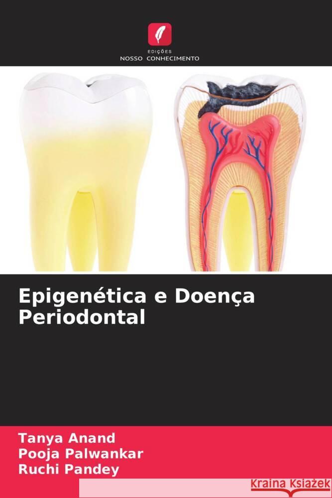 Epigenética e Doença Periodontal Anand, Tanya, Palwankar, Pooja, Pandey, Ruchi 9786204610740 Edições Nosso Conhecimento - książka