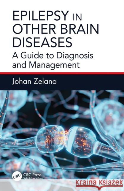 Epilepsy in Other Brain Diseases: A Guide to Diagnosis and Management Johan Zelano 9781032815213 CRC Press - książka